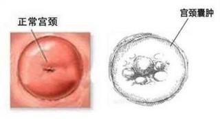 小红书:新澳精选资料免费提供-宫颈囊肿多发是什么意思