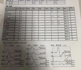 微博订阅:2024一肖一码100精准大全-肌电图主要检查什么病