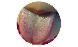 搜狐订阅：2O24澳彩管家婆资料传真-舌苔厚黄是什么原因