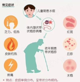 知乎：香港二四六开奖资料大全2022年-带状疱疹后遗神经痛用什么药