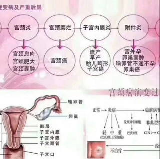 阿里巴巴:澳门精准一肖一码一必中一肖-宫颈糜烂用什么药好
