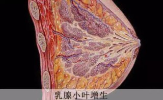 搜狐:4949退库-资料香港2024-双侧乳腺小叶增生是什么意思