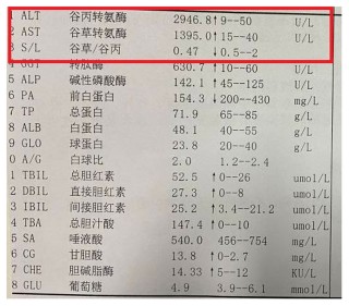 网易:4949免费资料2024年-转氨酶高是什么意思