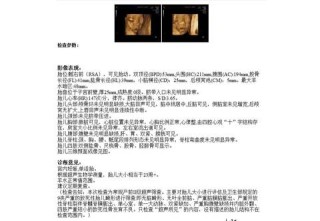知乎：2024香港正版挂牌-胎头位于耻上是什么意思
