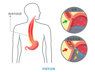 中新网:新奥门管家婆免费大全-鳞状上皮增生是什么意思