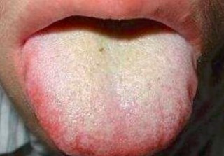 搜狐订阅：2O24澳彩管家婆资料传真-舌苔厚黄是什么原因