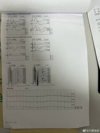 微博订阅:2024一肖一码100精准大全-肌电图主要检查什么病