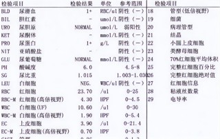 阿里巴巴:2024澳门正版资料免费大全-尿常规红细胞高是什么原因