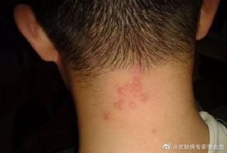 搜狐:王中王一肖一特一中开奖时间-毛囊炎吃什么药