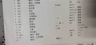 阿里巴巴:2024澳门正版资料免费大全-尿常规红细胞高是什么原因