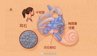 腾讯：新澳门王中王资料-耳石症吃什么药