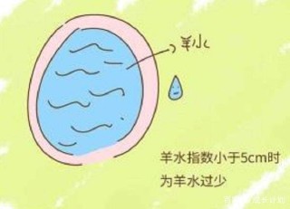 搜狐:澳门2024正版资料王中王-羊水少了对宝宝有什么影响
