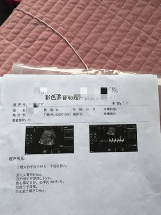火山视频:黄大仙精准内部三肖三码-公司监事是什么职位