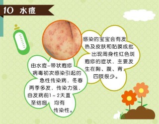 网易:新奥彩资料免费提供-水痘通过什么途径传染