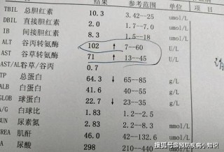 网易:4949免费资料2024年-转氨酶高是什么意思