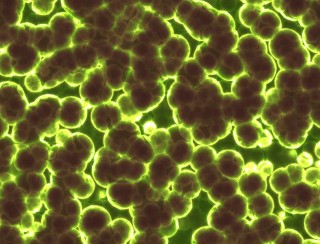 火山视频:4949开奖免费大全-男人下面真菌感染有什么症状