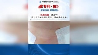 火山视频:2024年香港正版内部资料-甲状腺查什么科