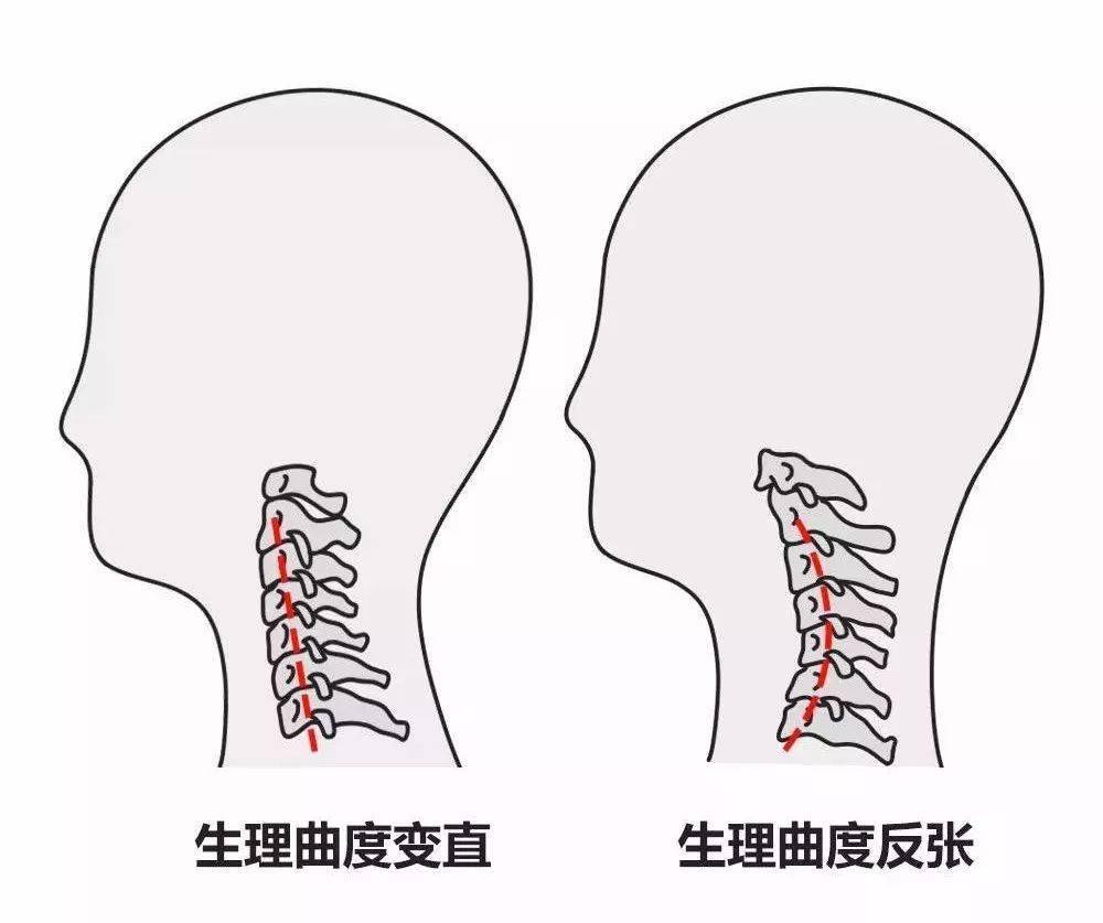 搜狐订阅：7777788888一肖一码-梦见自己剃光头是什么意思  第3张