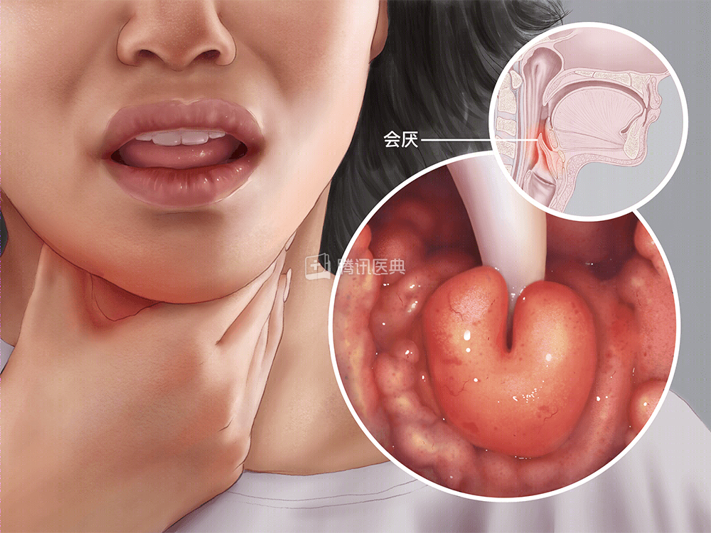 百家号:2o24澳门正版精准资料-嗓子中间的那块小肉叫什么  第3张