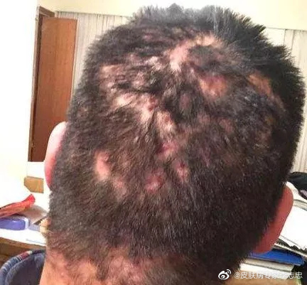搜狐:王中王一肖一特一中开奖时间-毛囊炎吃什么药  第2张