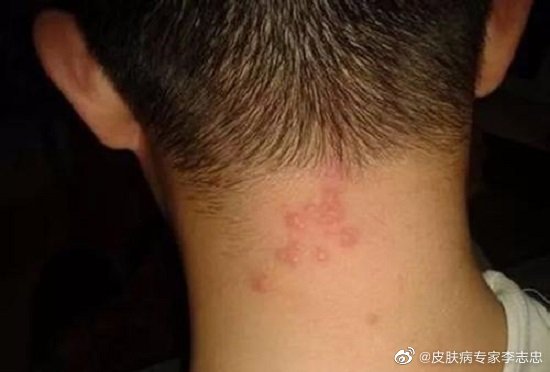 搜狐:王中王一肖一特一中开奖时间-毛囊炎吃什么药  第3张