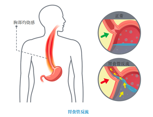 中新网:新奥门管家婆免费大全-鳞状上皮增生是什么意思  第3张