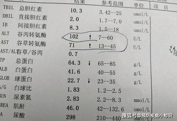 网易:4949免费资料2024年-转氨酶高是什么意思  第2张