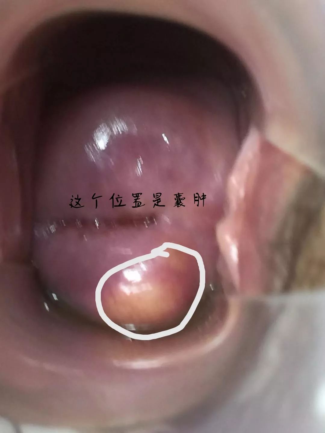 小红书:新澳精选资料免费提供-宫颈囊肿多发是什么意思  第3张