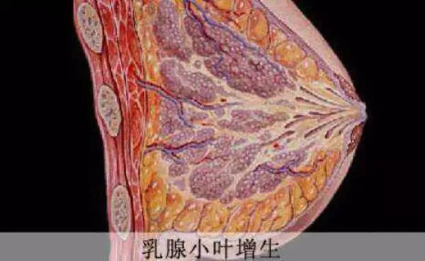 搜狐:4949退库-资料香港2024-双侧乳腺小叶增生是什么意思  第1张