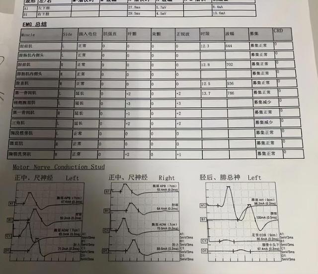 微博订阅:2024一肖一码100精准大全-肌电图主要检查什么病  第1张