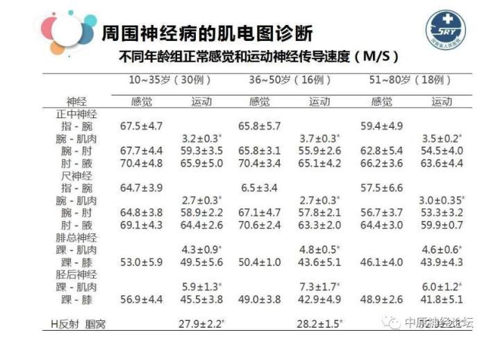 微博订阅:2024一肖一码100精准大全-肌电图主要检查什么病  第3张