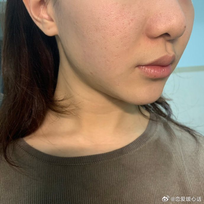 知乎：澳门一肖一码一必开一肖-哪个女明星痘坑多  第3张