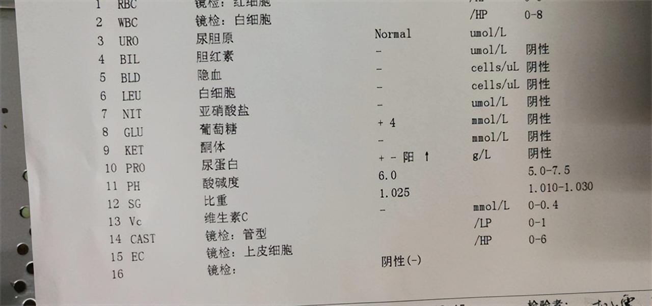 阿里巴巴:2024澳门正版资料免费大全-尿常规红细胞高是什么原因  第2张
