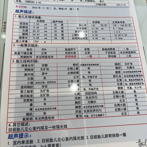 阿里巴巴:2024澳门正版资料免费大全-尿常规红细胞高是什么原因  第3张